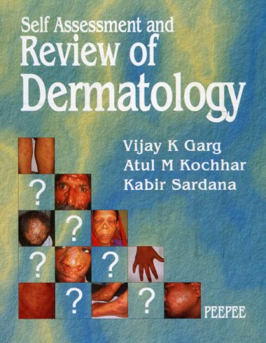 Childrens Toyshop  Books : Self Assessment and Review of Dermatology
