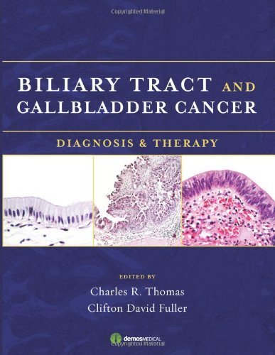 Biliary Tract and Gallbladder Cancer: Diagnosis & Therapy by Charles R. Thomas MD (2008-09-08)
