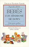 Bebes con sindrome de Down: guia para padres
