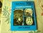 Cranial Mri: A Teaching File Approach
