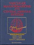 Vascular Malformations of the Central Nervous System