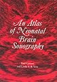 An Atlas of Neonatal Brain Sonography (Clinics in Developmental Medicine (Mac Keith Press))