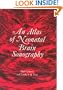 An Atlas of Neonatal Brain Sonography (Clinics in Developmental Medicine (Mac Keith Press))