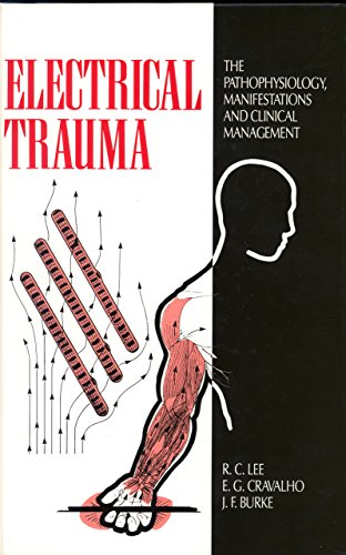 Electrical Trauma: The Pathophysiology, Manifestations and Clinical Management