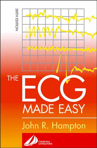 The ECG Made Easy