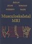 Musculoskeletal Mri