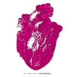 Remakes