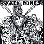 Dem Bones
