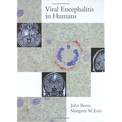 Viral Encephalitis in Humans