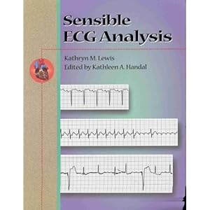 Ecg Analysis