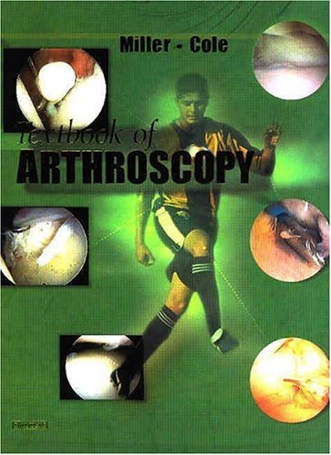 arthroscopic ankle surgery