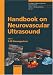 Book Handbook on Neurovascular Ultrasound (Frontiers of Neurology and Neuroscience)