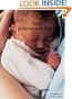 Your Premature Baby: The First Five Years