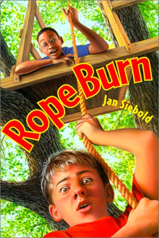 Burns