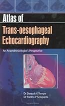 Atlas of Trans-Oesophageal Echocardiography: An Anaesthesiologist's Perspective Atlas of Trans-Oesophageal Echocardiography: An Anaesthesiologist's Perspective
