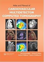 Atlas and Manual of Cardiovascular Multidetector Computed Tomography
