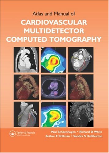 Computed-Tomography
