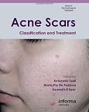 Acne Scars: Classification and Treatment (Series in Dermatological Treatment)