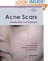 Acne Scars: Classification and Treatment (Series in Dermatological Treatment)