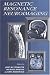 Books : Magnetic Resonance Neuroimaging