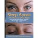 Sleep Apnea-The Phantom of the Night: Overcome Sleep Apnea Syndrome and Win Your Hidden Struggle to Breathe, Sleep, and Live