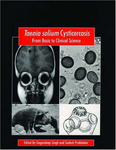 Cysticercosis