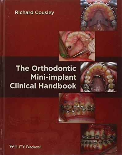 The Orthodontic Mini-implant Clinical Handbook by Richard Cousley (2013-05-06)
