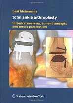 Total Ankle Arthroplasty: Historical Overview, Current Concepts and Future Perspectives