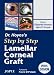 Dr. Hoyos' Step by Step Lamellar Corneal Graft with DVD-ROM