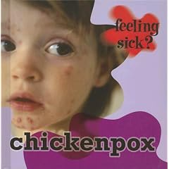 Click here to buy Chickenpox (Feeling Sick?) by Jillian Powell.