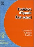 Proth�ses d'�paule : Etat actuel