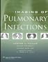 Imaging of Pulmonary Infections