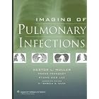 Imaging of Pulmonary Infections: A Fundamental and Clinical Text by Nestor L Müller, Tomás Franquet, Kyung Soo Lee, and C. IsabelaS Silva