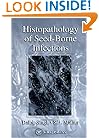 Histopathology of Seed-Borne Infections