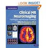 Clinical MR Neuroimaging: Physiological and Functional Techniques