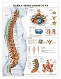 Human Spine Disorders Anatomical Chart 3D Raised Relief