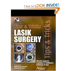 Lasik Surgery: Tips And Tricks
