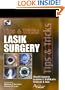 Lasik Surgery: Tips And Tricks