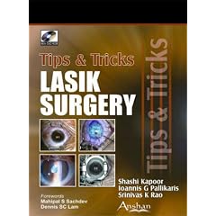 Lasik Surgery: Tips And Tricks