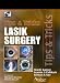 Lasik Surgery: Tips And Tricks