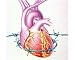 Photographic Print of Heart disease from Science Photo Library