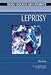 Leprosy (Deadly Diseases and Epidemics)