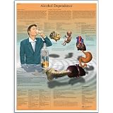 3B Scientific VR2792UU Glossy Paper Alcooldependance Anatomical Chart (Alcohol Dependence Anatomical Chart, French), Poster Size 20