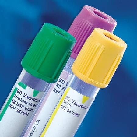 Becton Dic 67582800 Bd Vacutainer Plus Venous Blood Collection Tube Glucose Determination Sodium Fluoride / Edta 13 X 75 Mm 2 Ml Bd Hemogard Closure Plastic Tube 367587 Box Of 100