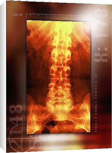 Canvas Prints of Healthy lower back, X-ray from Science Photo Library