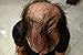 Finally Hair Fibers for Thinning Hair - 100% Undetectable Natural Formula - Completely Conceals Hair Loss in 15 Seconds - 25 Grams Refill Bag (Dark Brown)