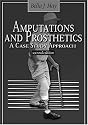 Amputations and Prosthetics: A Case Study Approach