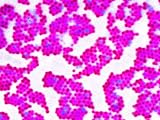 MRSA Infections Occur Most Frequently in Hospitals and Healthcare Photographic Poster Print, 24x18