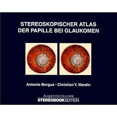 Stereoskopischer Atlas der Papille bei Glaukomen