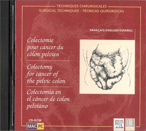 Colon-Cancer